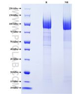 Recombinant Human CD44 protein (His Tag) Eg1057 proteintech