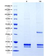 Recombinant Rat Nppa protein (His Tag) Eg1073 proteintech