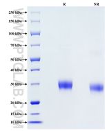 Recombinant Human Alpha-1-microglobulin protein (His Tag) Eg1127 proteintech