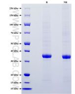 Recombinant Mouse Galectin-3 protein (His Tag) Eg1232 proteintech