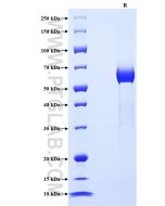 Recombinant Human CLEC10A/CD301 protein (rFc Tag) Eg1892 proteintech