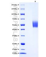 Recombinant Human KLRG1 protein (rFc Tag) Eg2036 proteintech
