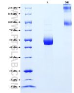 Recombinant Human IL-31 protein (rFc Tag) Eg2222 proteintech