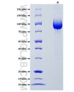 Recombinant Human GP2 protein (rFc Tag) Eg2446 proteintech
