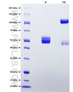 Recombinant Mouse TNC/Tenascin-C protein (rFc Tag) Eg2849 proteintech
