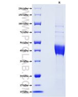 Recombinant Human Mammaglobin A protein (rFc Tag) Eg2887 proteintech