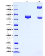 Recombinant Mouse ALPPL2 protein (rFc Tag) Eg2961 proteintech