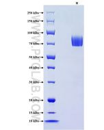 Recombinant Human L-selectin/CD62L protein (rFc Tag) Eg3006 proteintech
