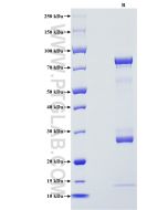 Recombinant Human MMP10 protein (rFc Tag) Eg3038 proteintech