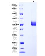 Recombinant Human SPINT2/HAI-2 protein (rFc Tag) Eg3130 proteintech