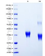 Recombinant Human IGFBP-6 protein (His Tag) Eg3437 proteintech