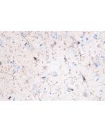 IHC easy ® IBA1 Ready-To-Use IHC Kit KHC0056 proteintech