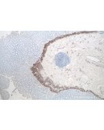 IHC easy ® Desmin Ready-To-Use IHC Kit KHC0100 proteintech