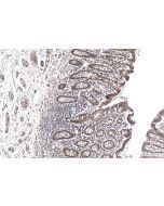 IHC easy ® VIRMA/KIAA1429 Ready-To-Use IHC Kit KHC0149 proteintech