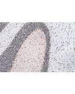 IHC easy ® YTHDF3 Ready-To-Use IHC Kit KHC0159 proteintech