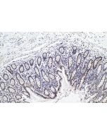 IHC easy ® HNRNPA2B1 Ready-To-Use IHC Kit KHC0163 proteintech