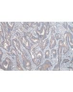IHC easy ® EIF3G Ready-To-Use IHC Kit KHC0170 proteintech