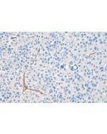 IHC easy ® PLVAP Ready-To-Use IHC Kit KHC0191 proteintech