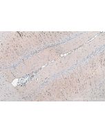 IHC easy ® S100A1 Ready-To-Use IHC Kit KHC0248 proteintech