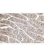 IHC easy ® Dystrophin/DMD Ready-To-Use IHC Kit KHC0284 proteintech