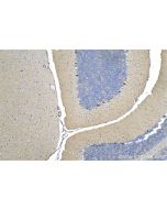 IHC easy ® CDH18 Ready-To-Use IHC Kit KHC0298 proteintech