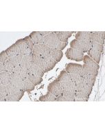 IHC easy ® CAPN3 Ready-To-Use IHC Kit KHC0318 proteintech