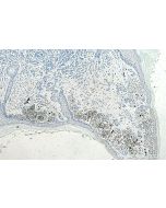 IHC easy ® ALPP/PLAP Ready-To-Use IHC Kit KHC0319 proteintech