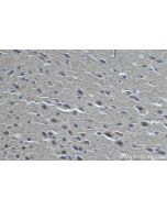 IHC easy ® CPT1C Ready-To-Use IHC Kit KHC0333 proteintech