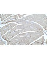 IHC easy ® MYL1 Ready-To-Use IHC Kit KHC0335 proteintech