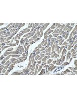 IHC easy ® MYL3 Ready-To-Use IHC Kit KHC0338 proteintech