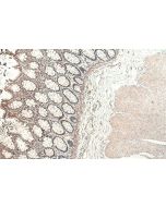 IHC easy ® SMAD1 Ready-To-Use IHC Kit KHC0389 proteintech