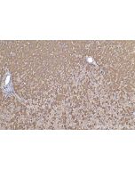 IHC easy ® TTR Ready-To-Use IHC Kit KHC0390 proteintech