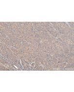 IHC easy ® ANXA2 Ready-To-Use IHC Kit KHC0396 proteintech