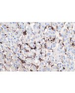 IHC easy ® ANXA1 Ready-To-Use IHC Kit KHC0399 proteintech
