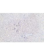 IHC easy ® CASP7 Ready-To-Use IHC Kit KHC0406 proteintech