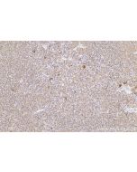 IHC easy ® GPX7 Ready-To-Use IHC Kit KHC0424 proteintech