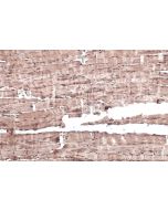IHC easy ® MBNL1 Ready-To-Use IHC Kit KHC0433 proteintech