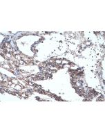 IHC easy ® SOD2 Ready-To-Use IHC Kit KHC0465 proteintech