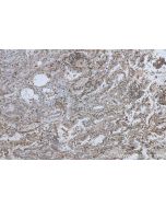 IHC easy ® CD71 Ready-To-Use IHC Kit KHC0496 proteintech