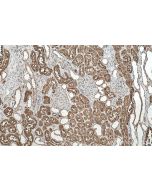 IHC easy ® TXN Ready-To-Use IHC Kit KHC0529 proteintech