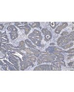 IHC easy ® GRP94/HSP90B1 Ready-To-Use IHC Kit KHC0531 proteintech