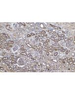 IHC easy ® IDH1 Ready-To-Use IHC Kit KHC0541 proteintech