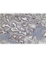 IHC easy ® HSD17B10 Ready-To-Use IHC Kit KHC0543 proteintech
