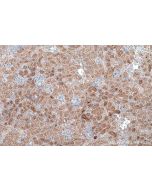 IHC easy ® GSTP1 Ready-To-Use IHC Kit KHC0548 proteintech