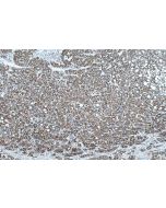 IHC easy ® PRDX3 Ready-To-Use IHC Kit KHC0562 proteintech