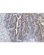 IHC easy ® HSD17B2 Ready-To-Use IHC Kit KHC0625 proteintech