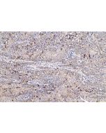 IHC easy ® IGFBP3 Ready-To-Use IHC Kit KHC0629 proteintech