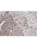IHC easy ® PRMT5 Ready-To-Use IHC Kit KHC0636 proteintech