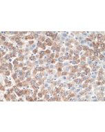 IHC easy ® NNT Ready-To-Use IHC Kit KHC0645 proteintech
