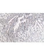 IHC easy ® TKT Ready-To-Use IHC Kit KHC0672 proteintech